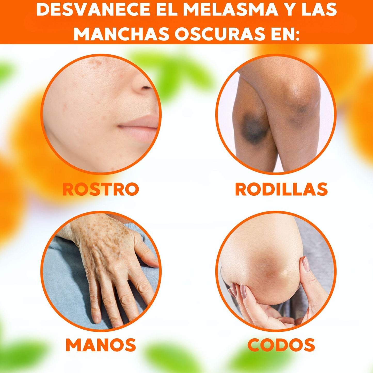 Serum Vitamina C Gel Neoprosone Despigmentante Aclarante Blanqueadora - Con Vitamina C Y Alfa Arbutina - Resultados En 2 Semanas - 30 Ml