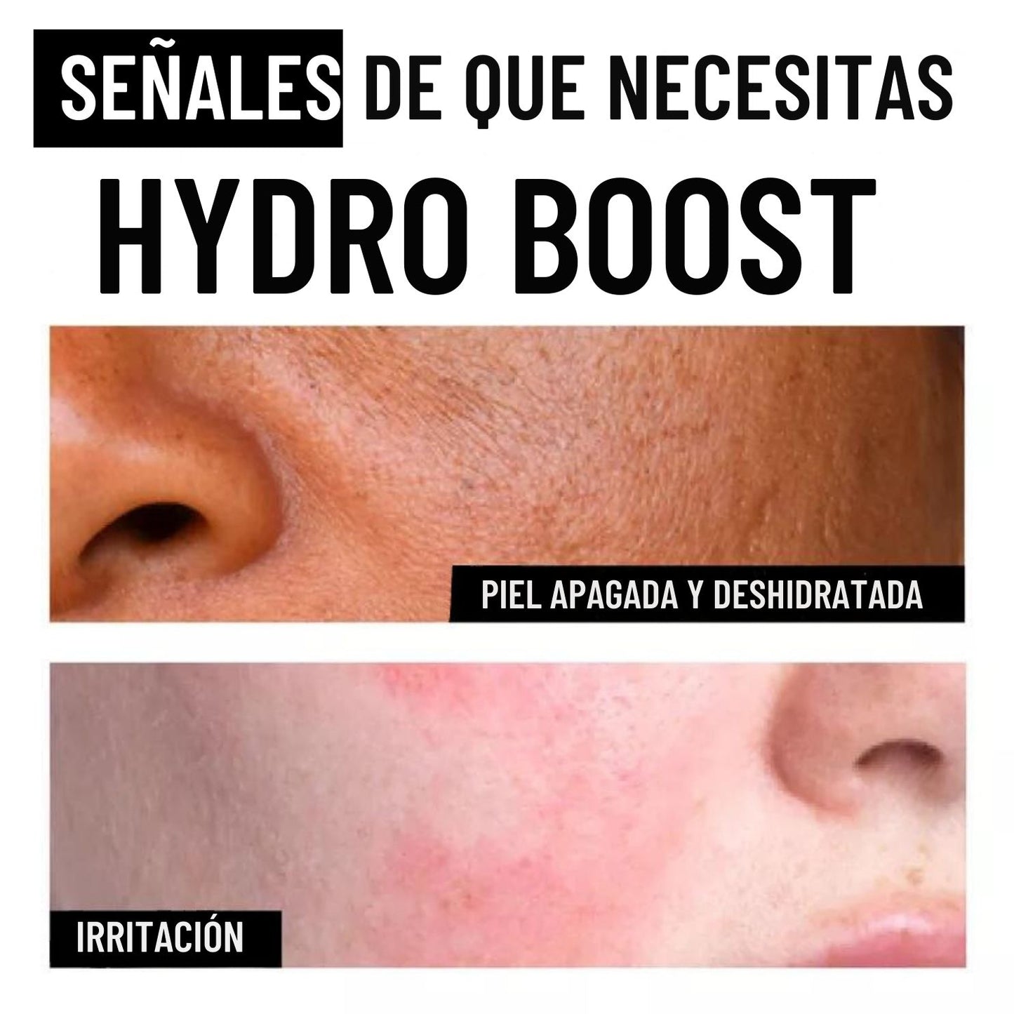 Neutrogena Hydro Boost Acido Hialuronico Gel Hidratante