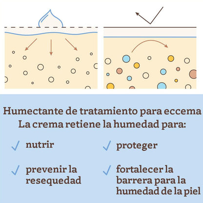 Aveeno Baby Terapia De Eczema Crema Humectante De 354ml